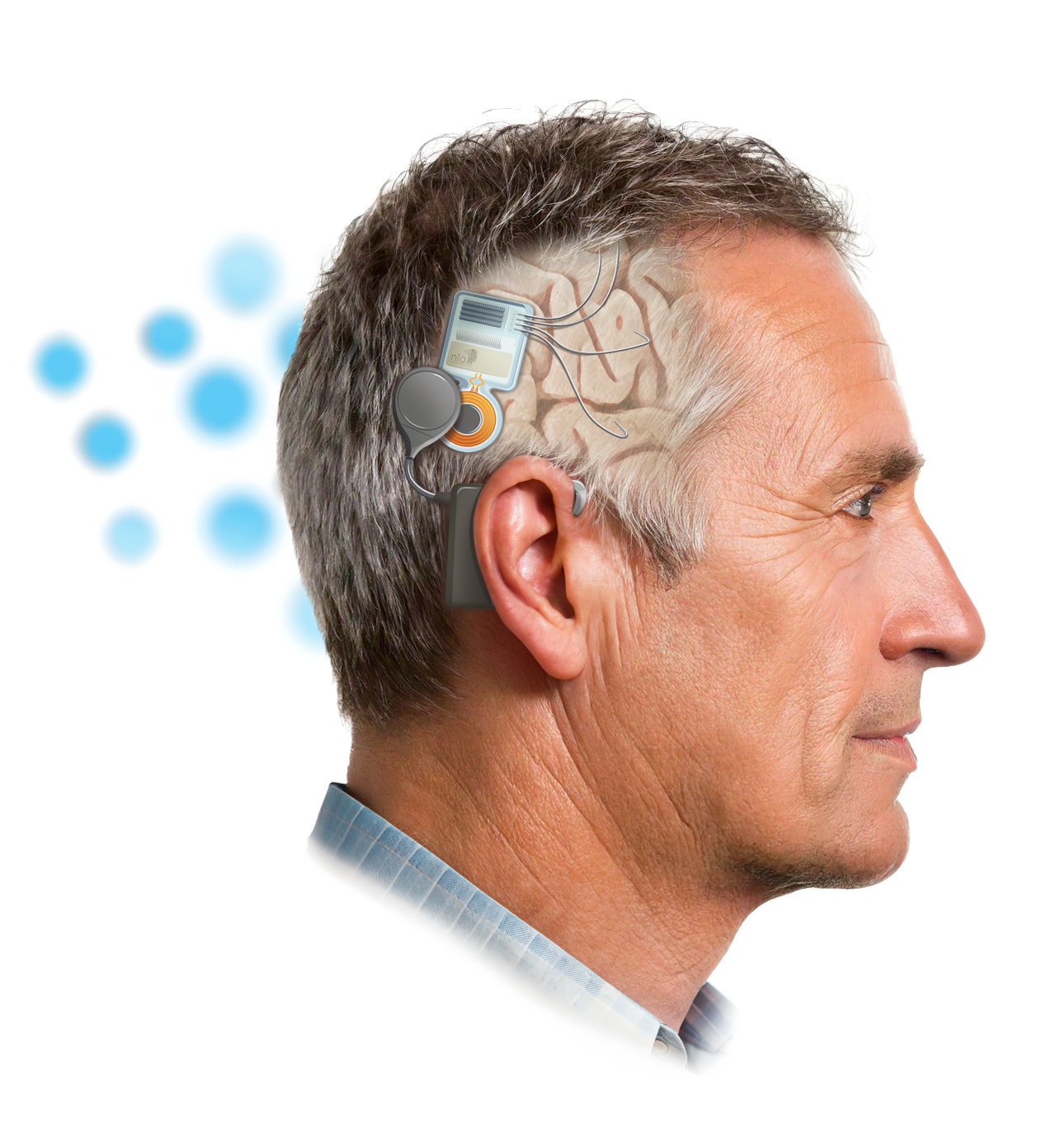 Smart Neurostimulation System
